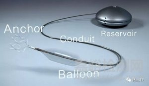 Aria CV PH:全新肺動(dòng)脈高壓治療儀,使肺動(dòng)脈重新變得富有彈性