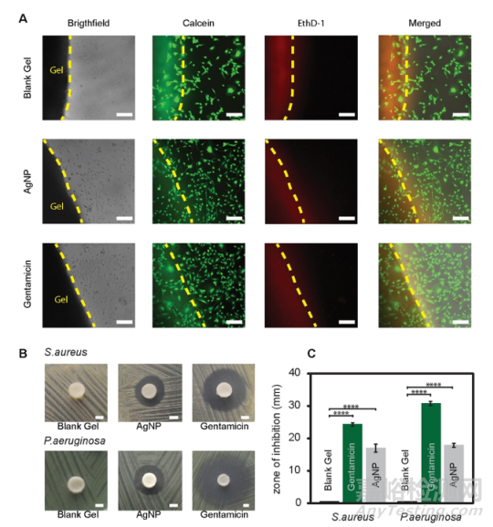 3D打印水凝膠敷料可適用于傷口治療
