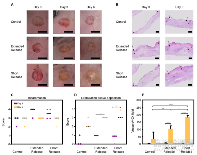 3D打印水凝膠敷料可適用于傷口治療
