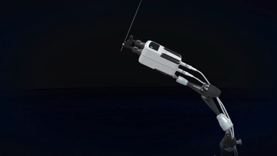 Micromate:FDA批準(zhǔn)最小經(jīng)皮介入手術(shù)機器人