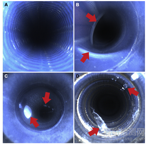 軟式支氣管鏡和超聲支氣管鏡再處理的有效性