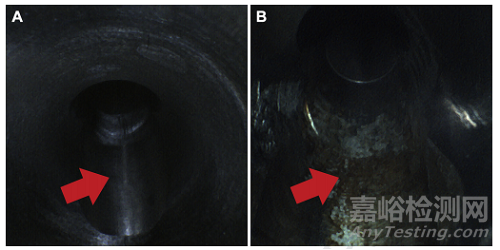 軟式支氣管鏡和超聲支氣管鏡再處理的有效性