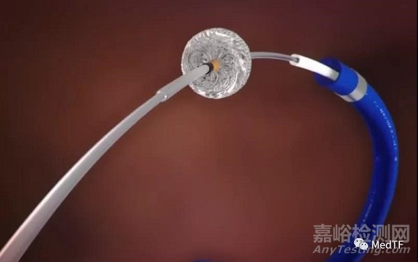 DAISe:取栓不只是支架和抽吸