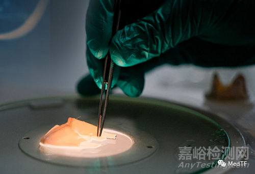 SingValve：首款允許私人定制的二尖瓣瓣膜