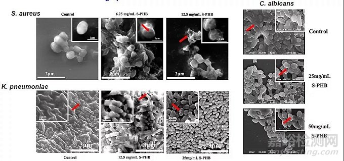 生物基廣譜抗菌紡織品的研究及發(fā)展趨勢