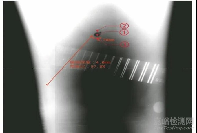 在役管道腐蝕坑深度的DR檢測