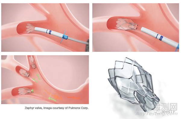 2021年最具創(chuàng)新性的18個(gè)醫(yī)療器械