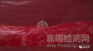 Venock vascular closure：完全可吸收的大口徑靜脈血管閉合器