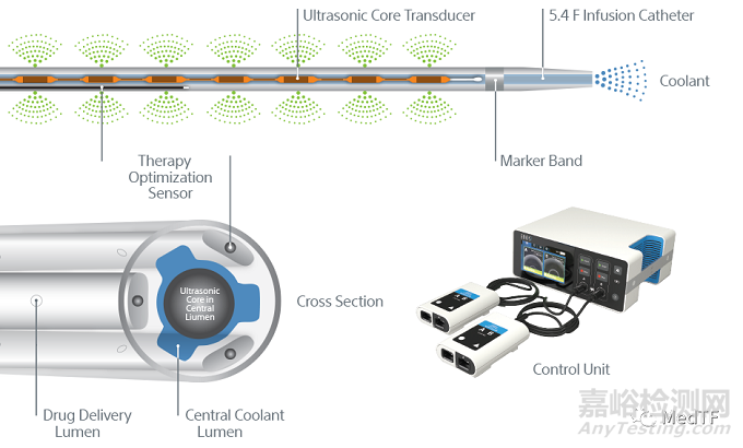 波科對(duì)治療肺栓塞(PE)的EkoSonic啟動(dòng)大規(guī)模臨床研究