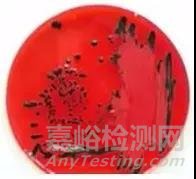 GB 4789.4-2016 沙門氏菌的檢驗過程及操作時的注意事項