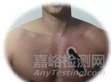 醫(yī)用可穿戴心電設(shè)備的研發(fā)發(fā)展最新情況
