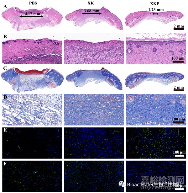 具有優(yōu)異的抗菌活性和快速形狀適應(yīng)性的復(fù)合食品膠水凝膠用于加速細菌感染傷口愈合|Bioactive Materials
