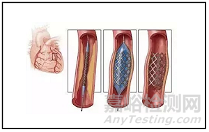 何為理想的醫(yī)療器械