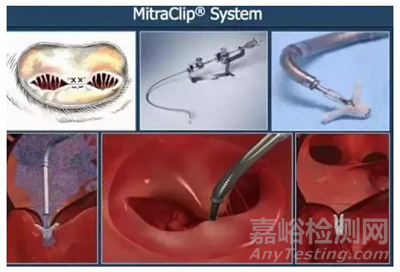 何為理想的醫(yī)療器械