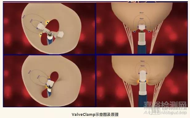 ValveClamp 完成10例功能性二尖瓣反流探索性臨床研究