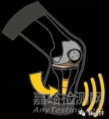 FDA批準(zhǔn)首款智能膝關(guān)節(jié)-Persona IQ