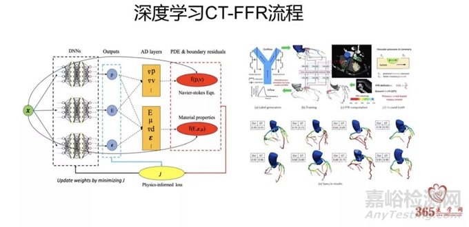 機(jī)器學(xué)習(xí)在心血管影像診斷上的應(yīng)用