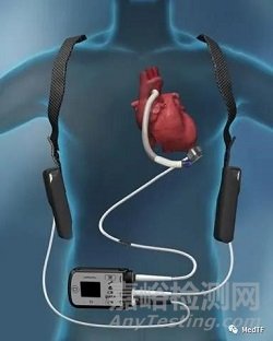 CardiacBooster Device：流量最大的心臟泵
