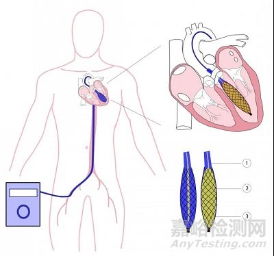 CardiacBooster Device：流量最大的心臟泵