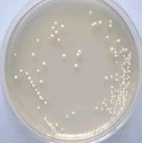 微生物實(shí)驗(yàn)室的菌種鑒定小結(jié)