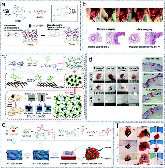 《JMCB》四川大學王軍: 用于組織工程的自粘水凝膠