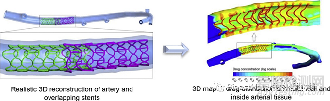 藥械組合產(chǎn)品的監(jiān)管考量