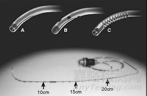 硬膜外導(dǎo)管不同設(shè)計對特性和輸注泵報警壓力的影響