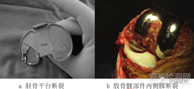 全膝關(guān)節(jié)假體系統(tǒng)體外功能試驗(yàn)標(biāo)準(zhǔn)及評(píng)估方法