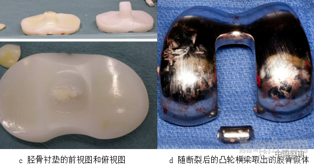 全膝關(guān)節(jié)假體系統(tǒng)體外功能試驗(yàn)標(biāo)準(zhǔn)及評(píng)估方法