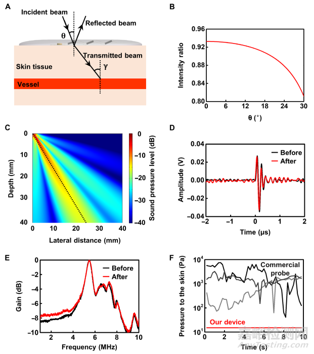清華大學(xué)馮雪教授《Sci.Adv.》：可以貼在皮膚上的柔性多普勒超聲儀