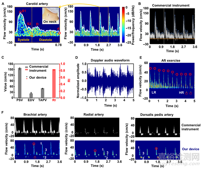 清華大學(xué)馮雪教授《Sci.Adv.》：可以貼在皮膚上的柔性多普勒超聲儀