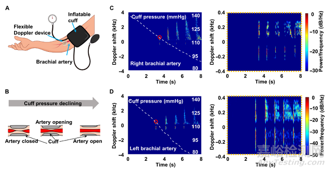 清華大學(xué)馮雪教授《Sci.Adv.》：可以貼在皮膚上的柔性多普勒超聲儀
