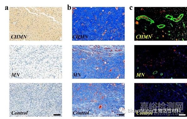 中藥微針補片用于創(chuàng)面修復(fù)|Bioactive Materials