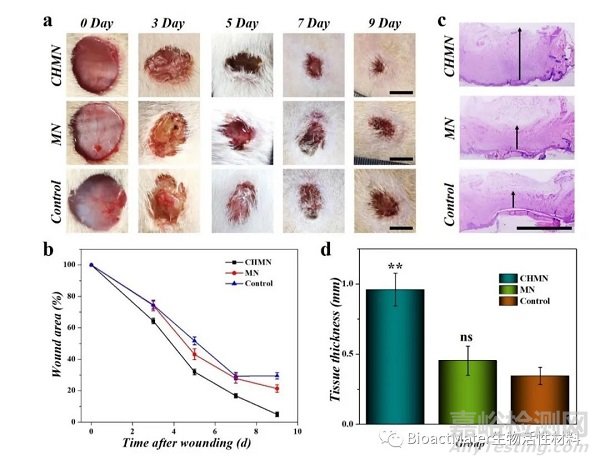 中藥微針補片用于創(chuàng)面修復(fù)|Bioactive Materials