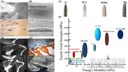 可生物降解鎂界面螺釘在ACL重建中的臨床應用與挑戰(zhàn)