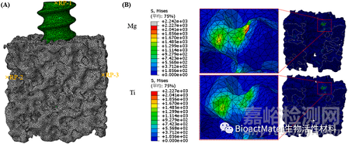 可生物降解鎂界面螺釘在ACL重建中的臨床應用與挑戰(zhàn)