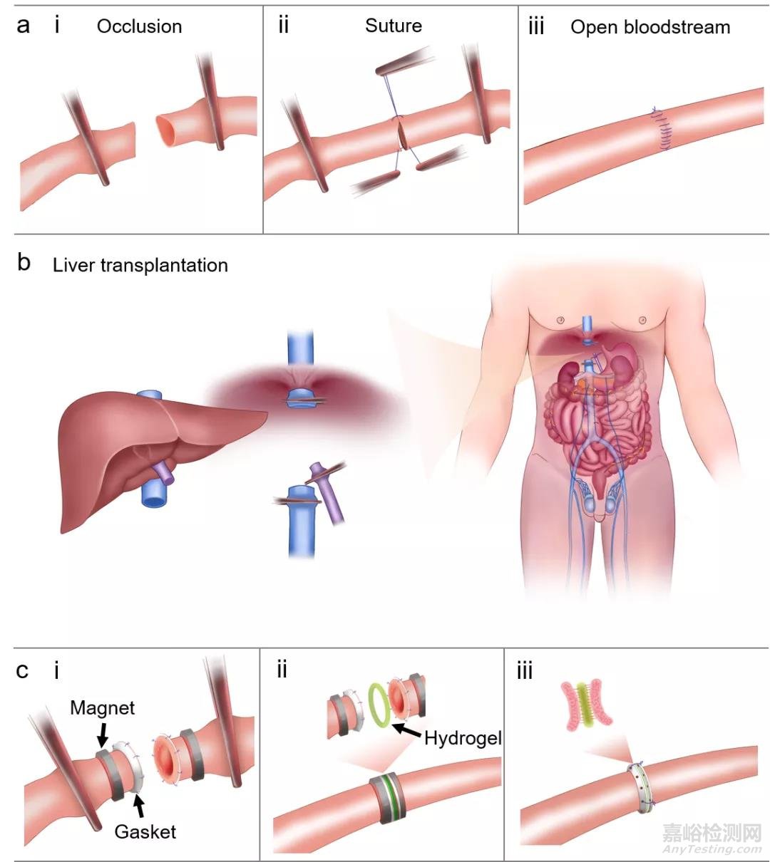 磁輔助-水凝膠粘接方法用于器官移植