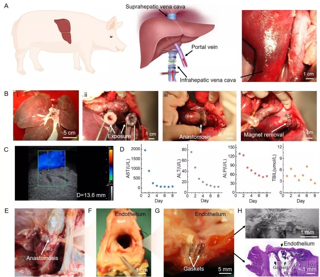 磁輔助-水凝膠粘接方法用于器官移植