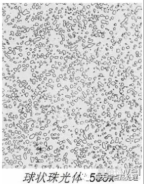 最全碳鋼金相微觀組織解析