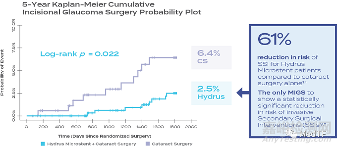 愛爾康30億收購 重回青光眼支架