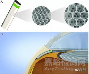 MINIject:首款青光眼自然引流器械獲CE批準(zhǔn)