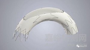 SYNAXIS:主動脈弓過濾器 開啟全新中風預(yù)防理念