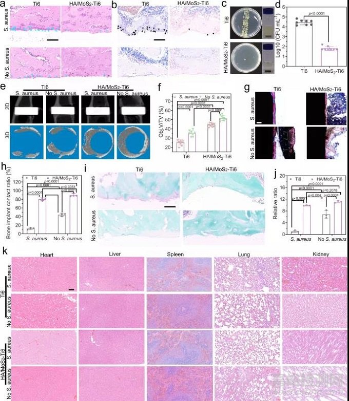 多功能骨種植體，兼具高效抗菌活性和成骨能力