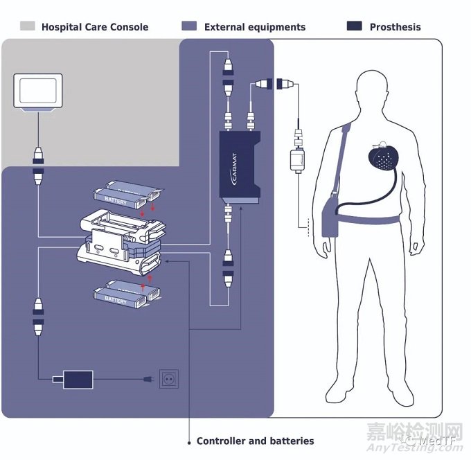 Aeson:CARMAT宣布因質(zhì)量問題暫停人工心臟植入