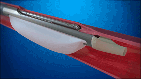 BlueLeaf：首款介入“自然”靜脈瓣 獲FDA“突破性設(shè)備”稱號