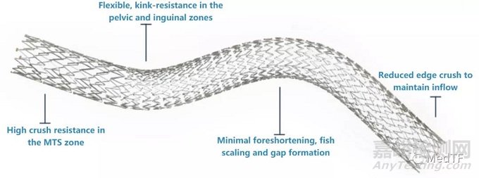 Vesper Duo:飛利浦相中靜脈支架 完善靜脈產(chǎn)品線