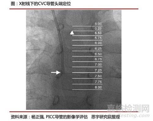 手術(shù)機(jī)器人空間定位系統(tǒng)技術(shù)原理