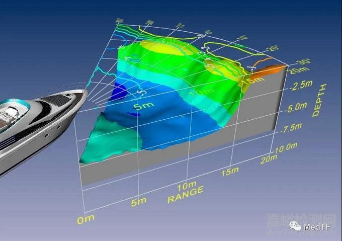 SLT IVUS：具有聲吶功能IVUS 實時提供血管流腔尺寸