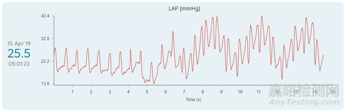 V-LAP:世界上首臺心內(nèi)微型計算機 實時監(jiān)測心衰