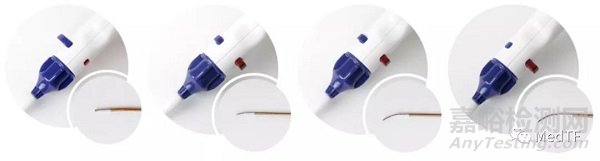 GoBack: 2.9F單腔CTO導(dǎo)管 既能順行也能逆行